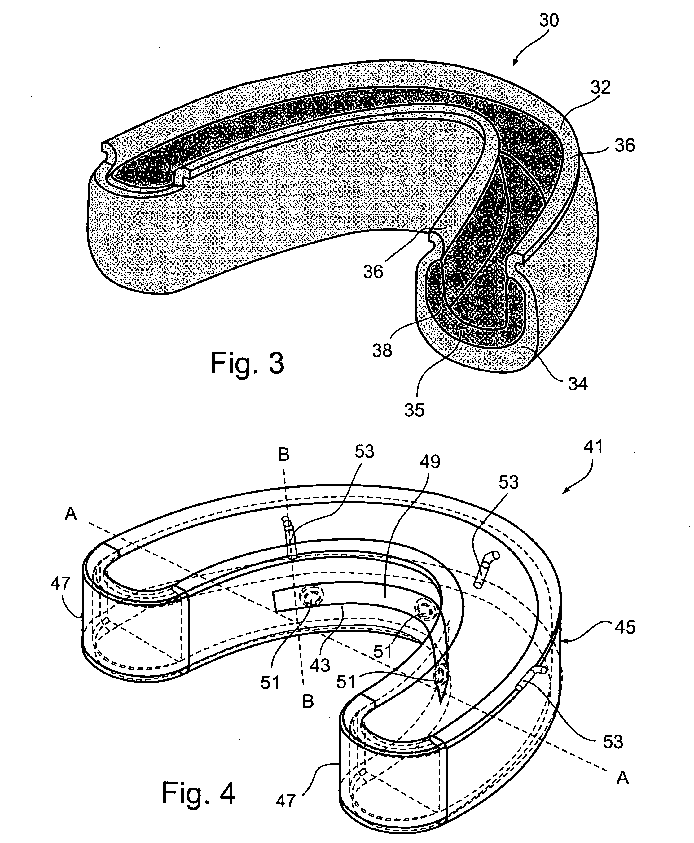 Electrochemically treating teeth