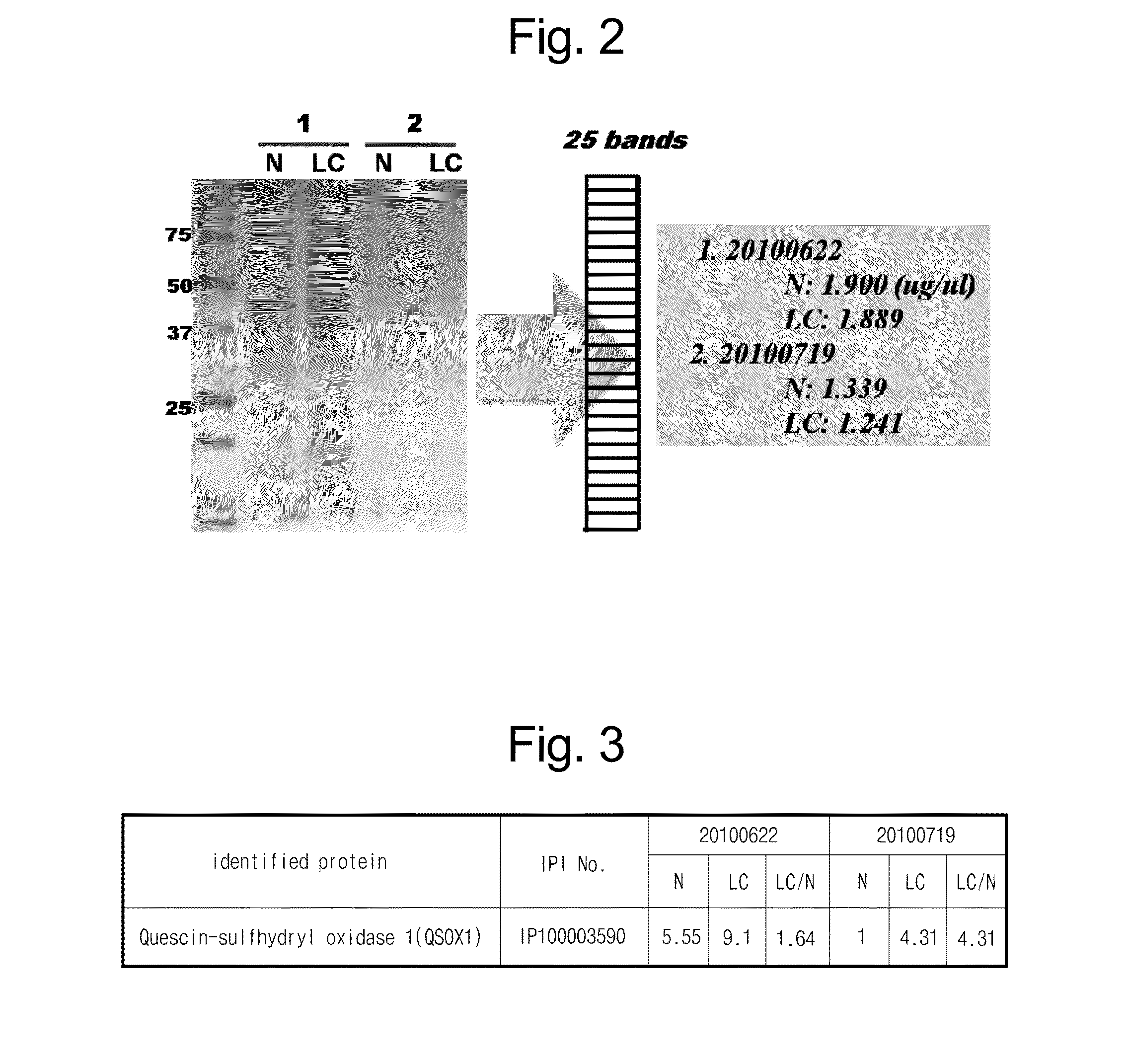 Composition for diagnosis of lung cancer and diagnosis kit of lung cancer