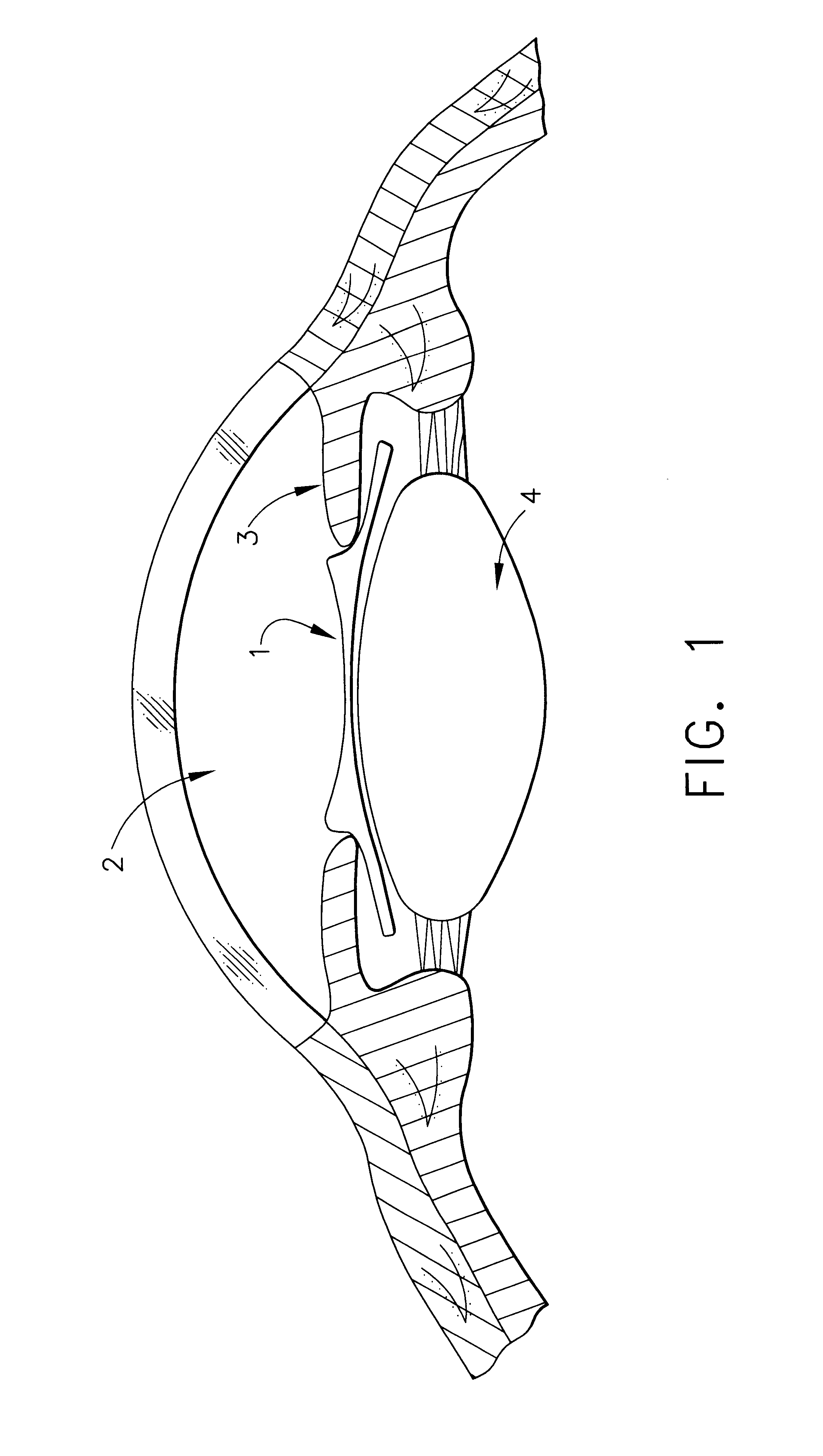 Floating phakic refractive lens design for preserving eye dynamics