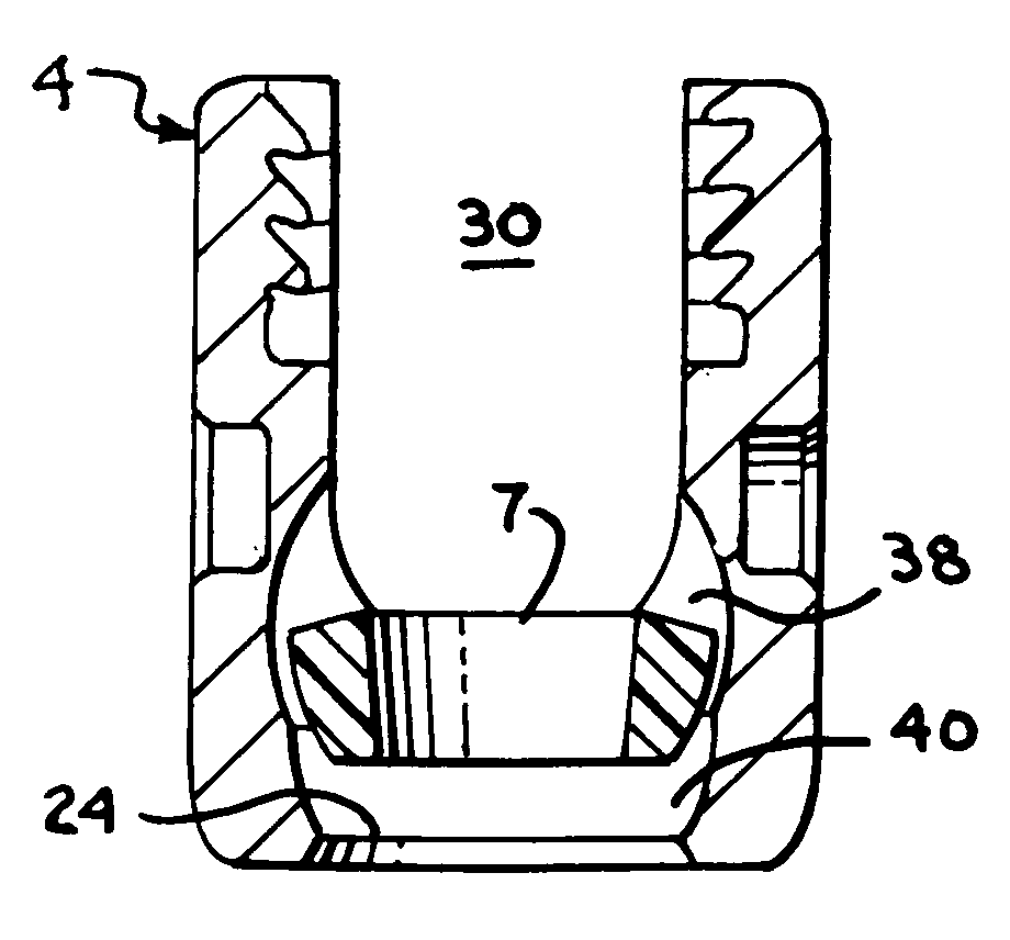 Polyaxial bone screw with split retainer ring