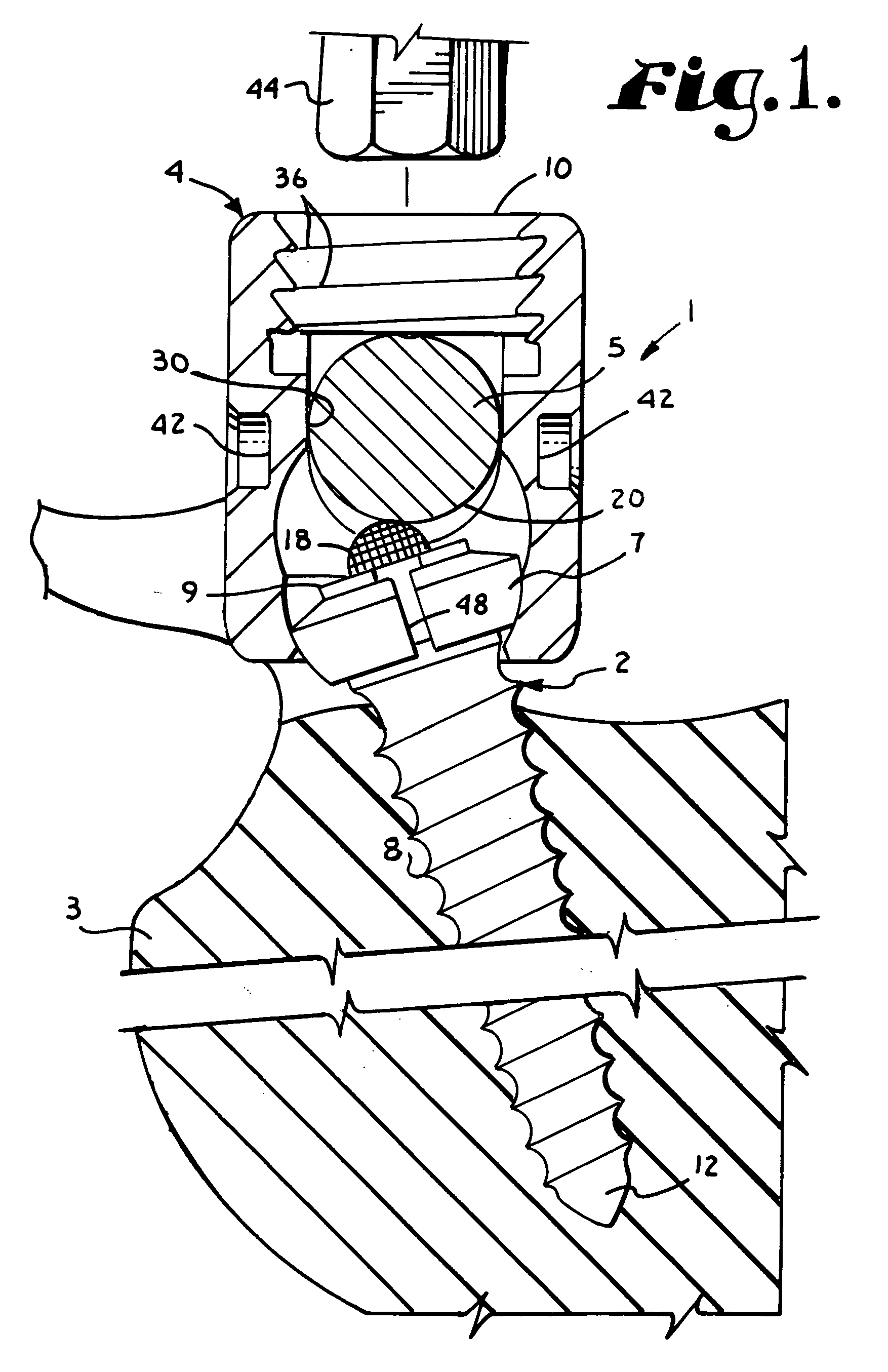 Polyaxial bone screw with split retainer ring