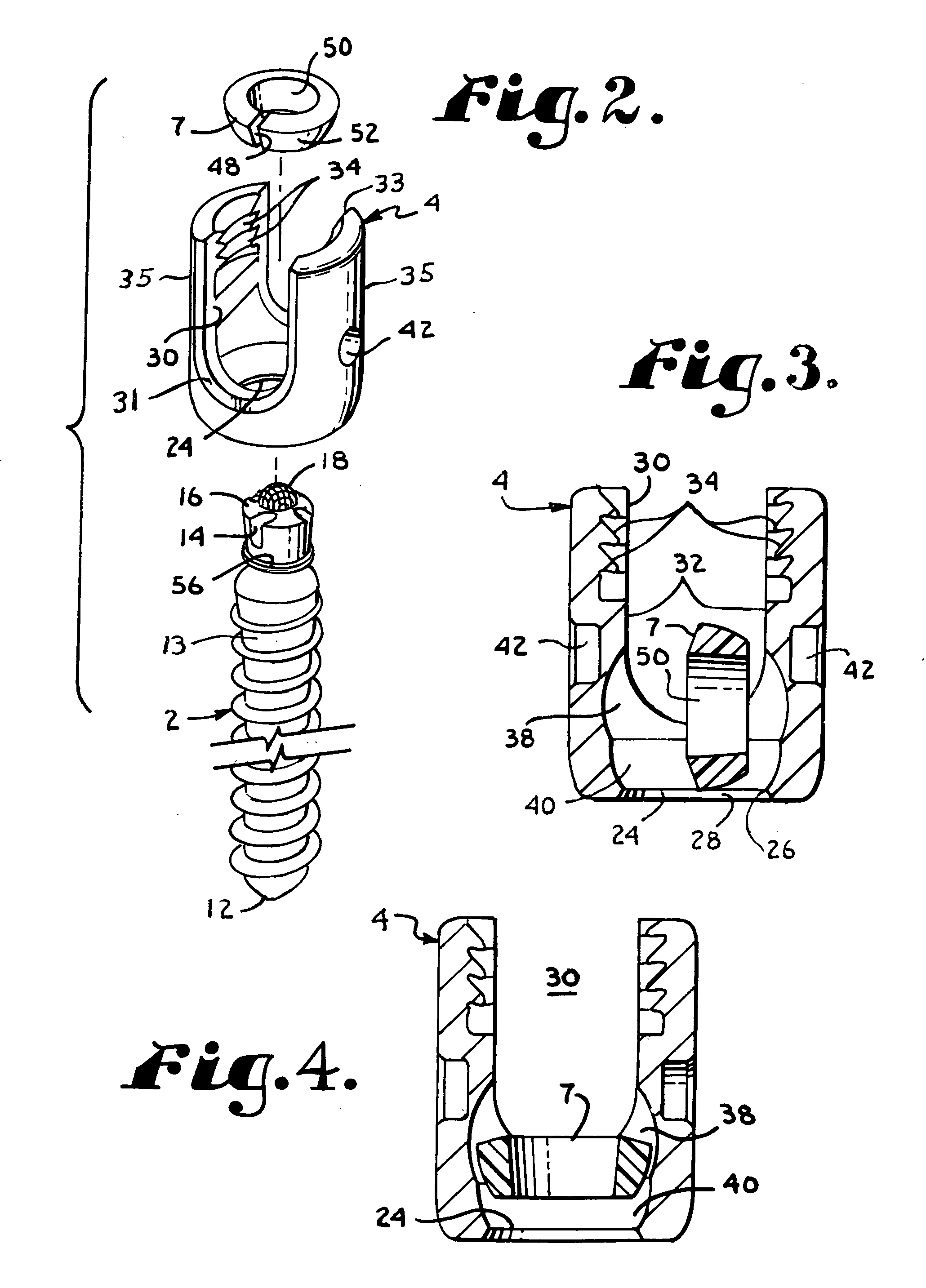 Polyaxial bone screw with split retainer ring