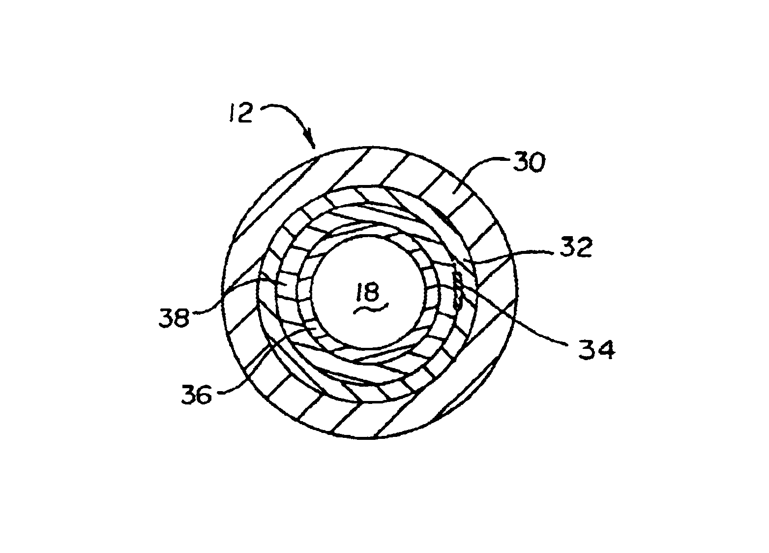 Intravascular catheter with composite reinforcement