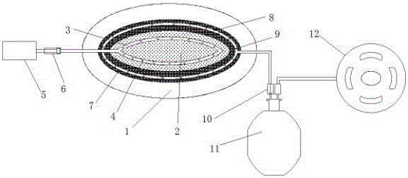 Portable negative pressure suction device for wound management for department of burn and plastic surgery