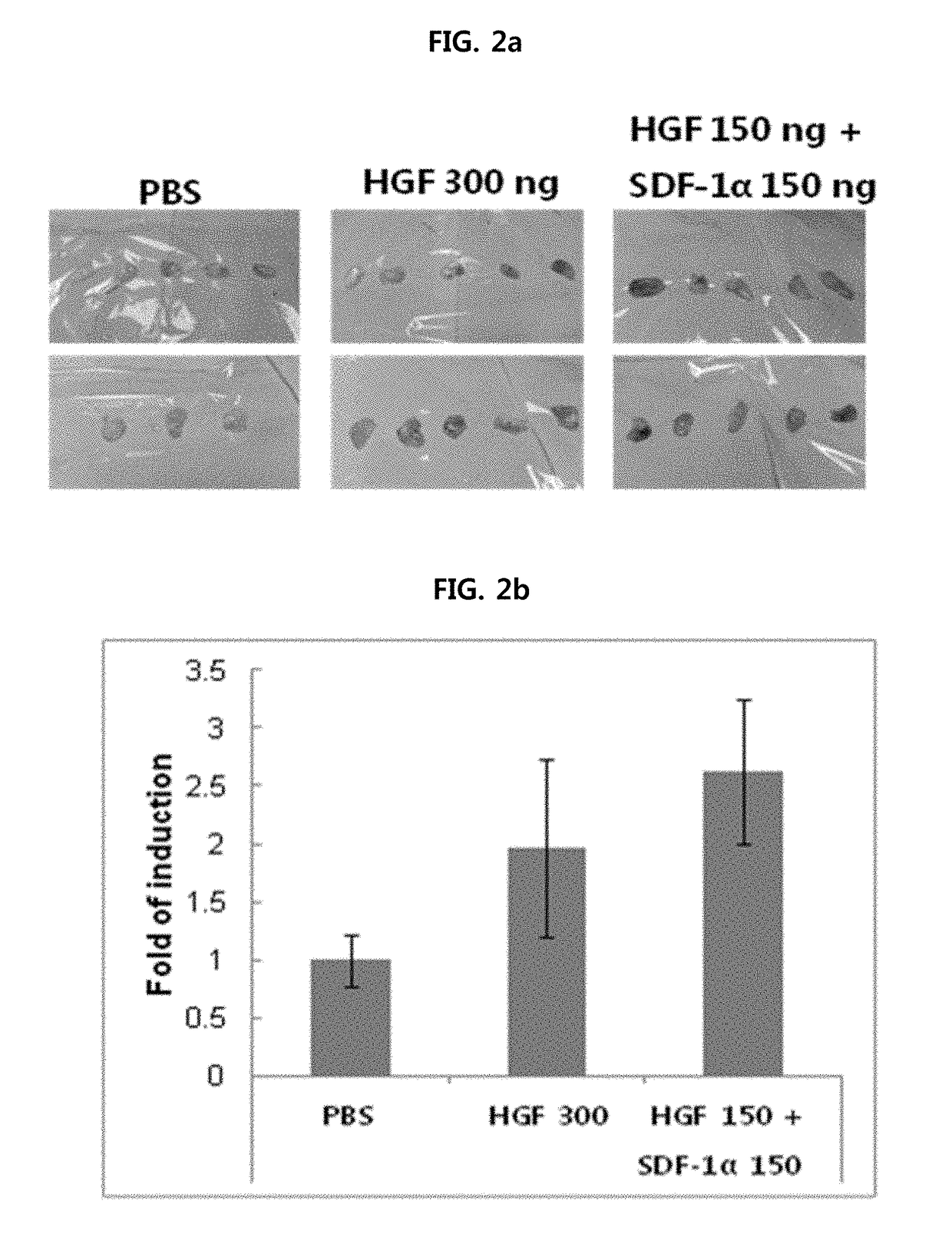 Composition for preventing or treating peripheral vascular disease using hepatocyte growth factor and stromal cell derived factor 1a