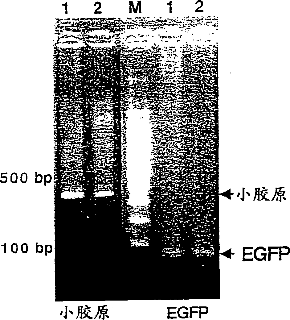 Transformed silkworm producing human collagen