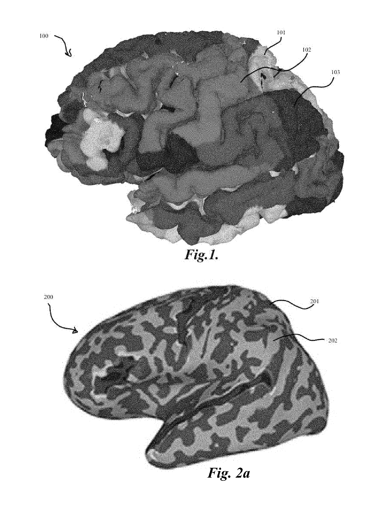 Methods for localization and visualization of electrodes and probes in the brain using anatomical mesh models