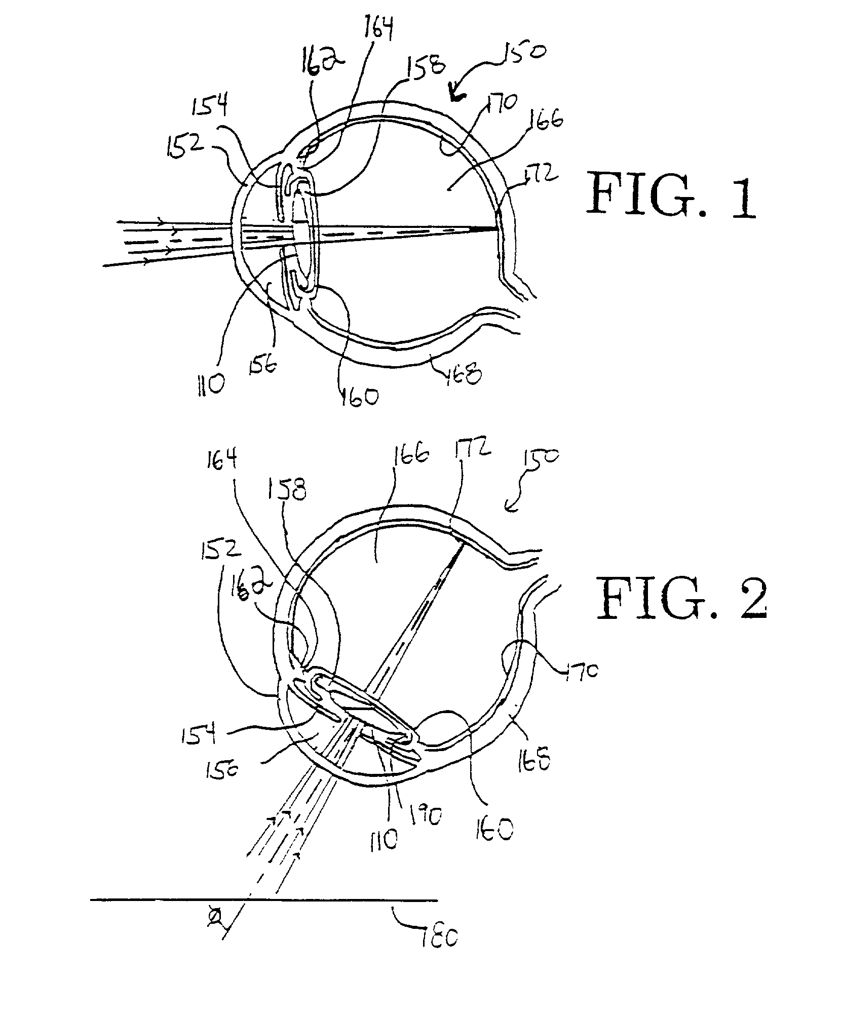 Multi-focal intraocular lens