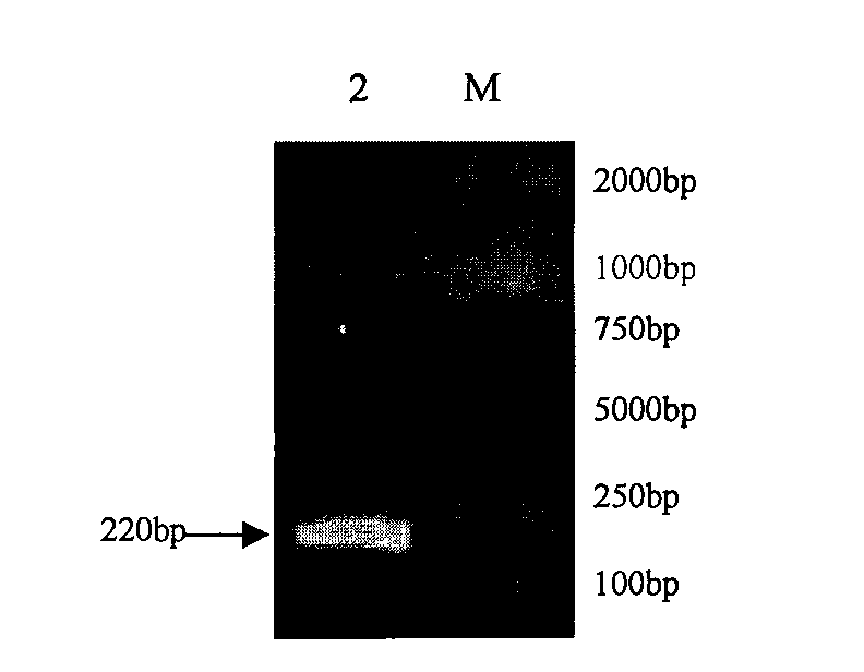 Recombinant adenovirus expressing mycoplasma hyopneumoniae P102 protein and applications thereof