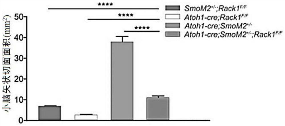 Application of rack1 as a target in the preparation of anti-shh subtype medulloblastoma drugs