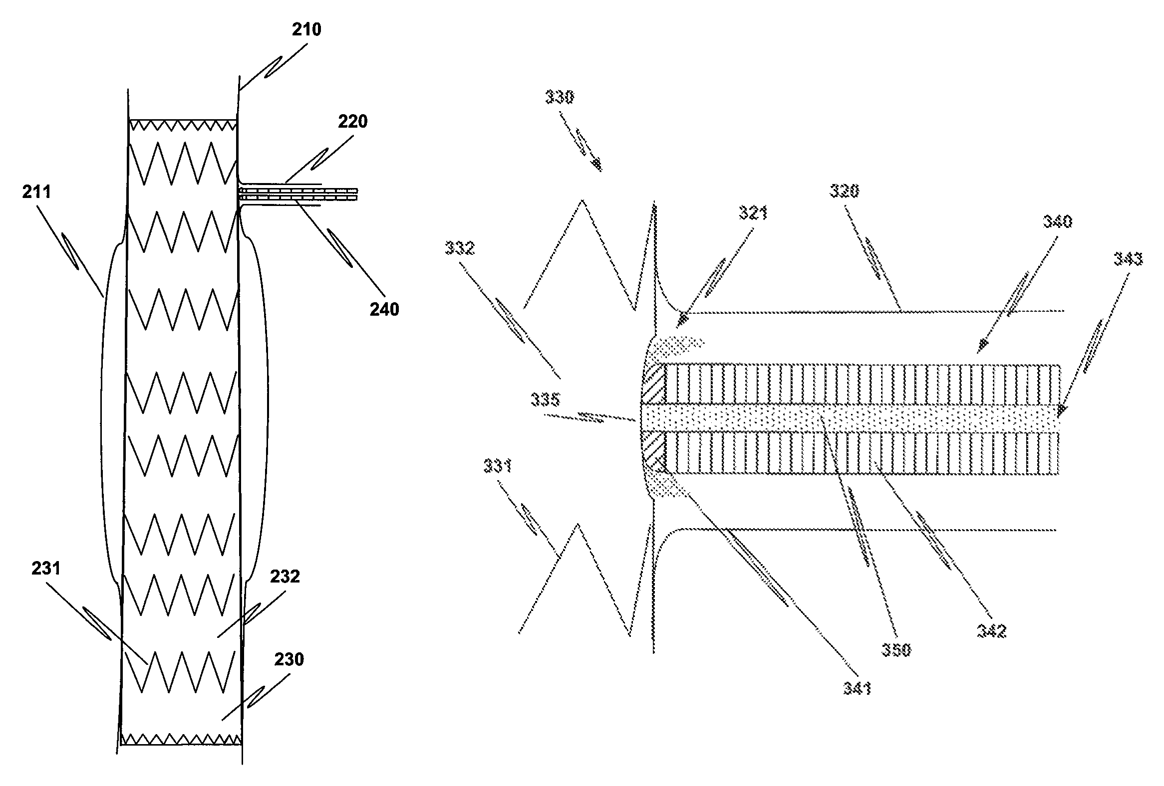 Method and structure for ameliorating side-effects of performing in situ fenestration using a plasma RF catheter