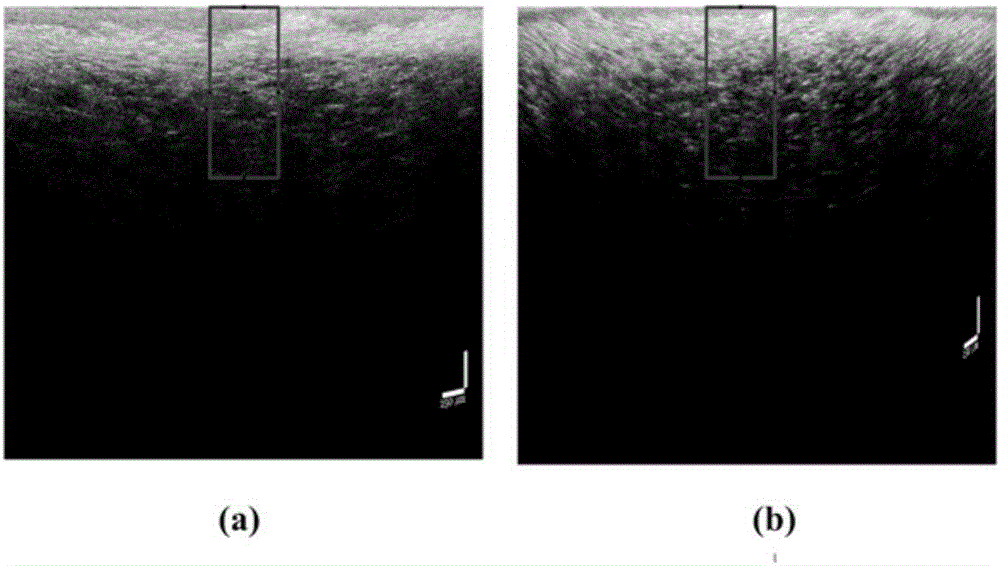 Method for identifying early-phase bruise of loquat through SD-OCT image