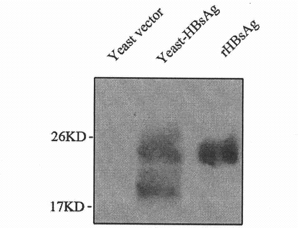 Vaccine for controlling persistent infection of hepatitis B virus