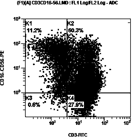 Preparation method of polylineage activated killer cells for tumor immunotherapy