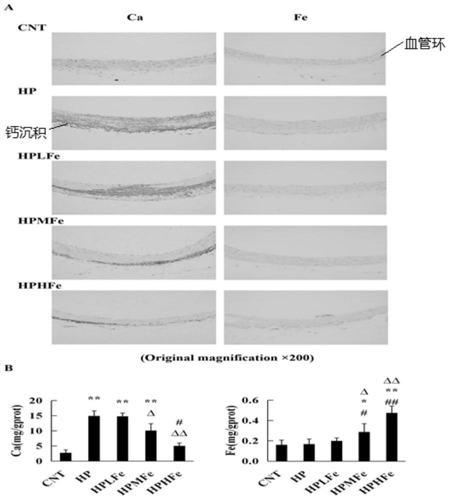 Application of iron sucrose in preparation of medicine for treating hyperphosphatemia-induced vascular calcification