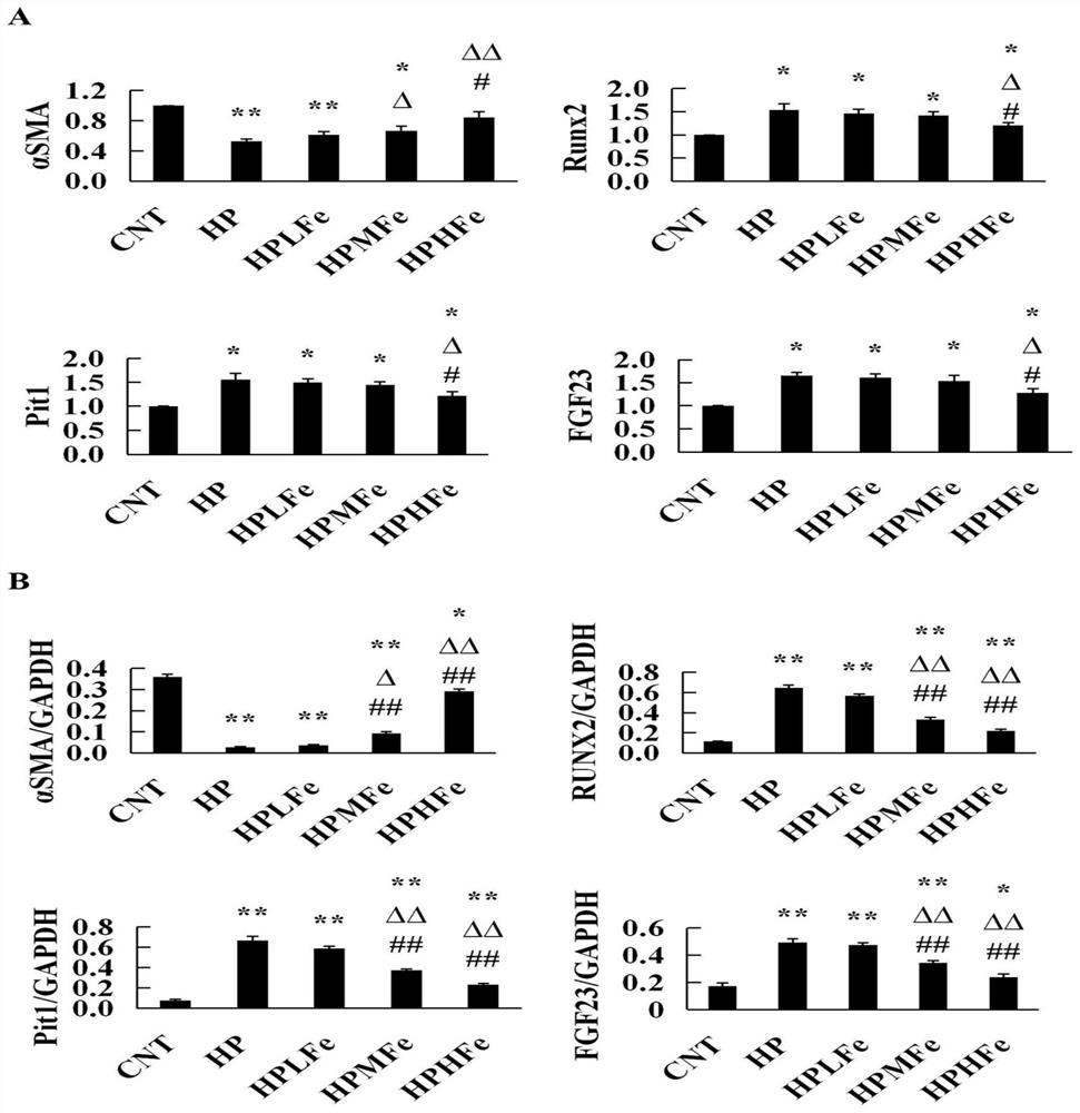 Application of iron sucrose in preparation of medicine for treating hyperphosphatemia-induced vascular calcification