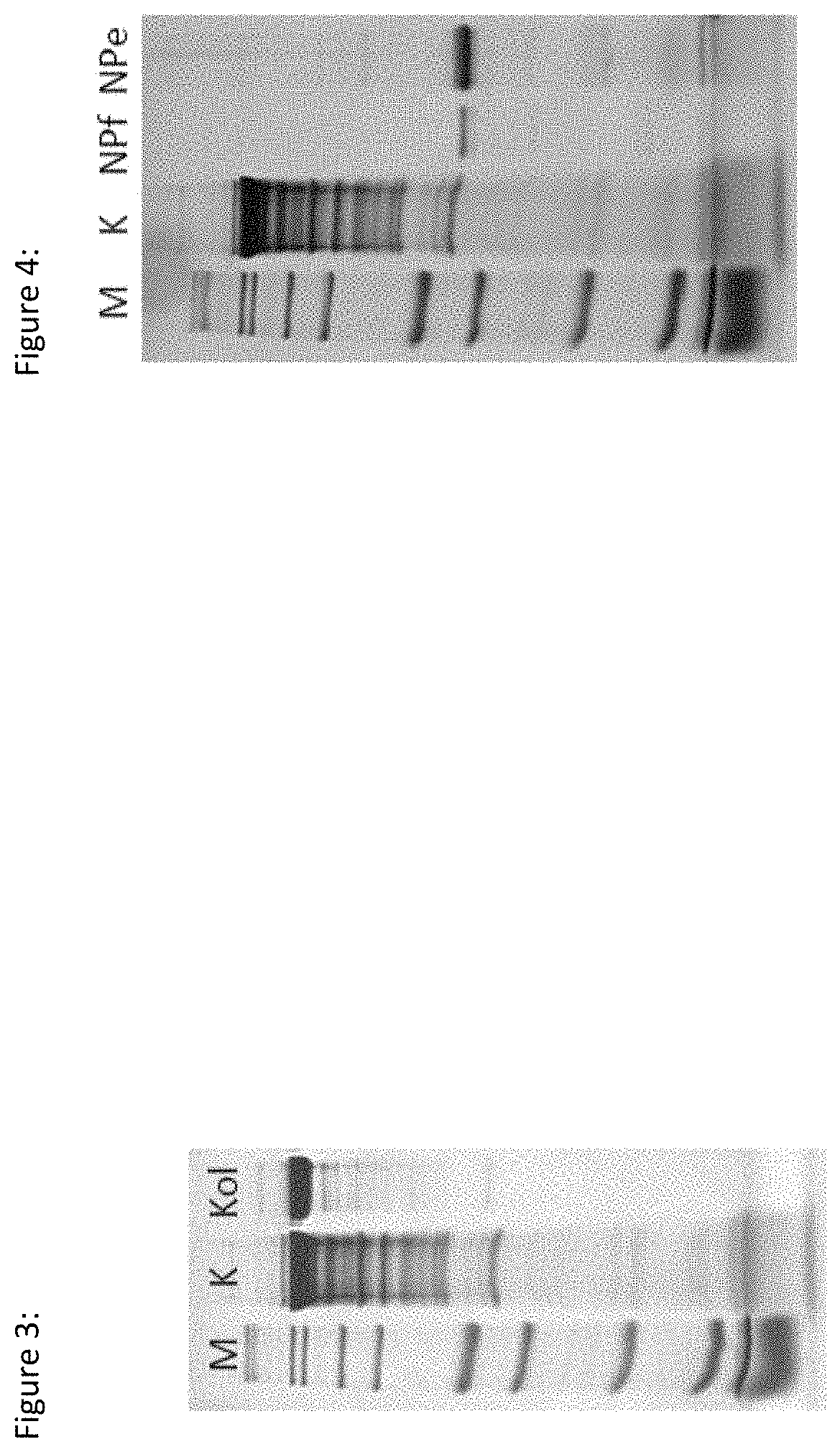 Chromatographic purification of at least one enzyme selected from a group including collagenase type i, collagenase type ii, neutral protease and clostripain