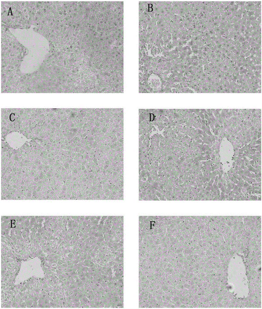 Application of Cordyceps sobolifera water extract in preparation of acute liver injury preventing and treating drug