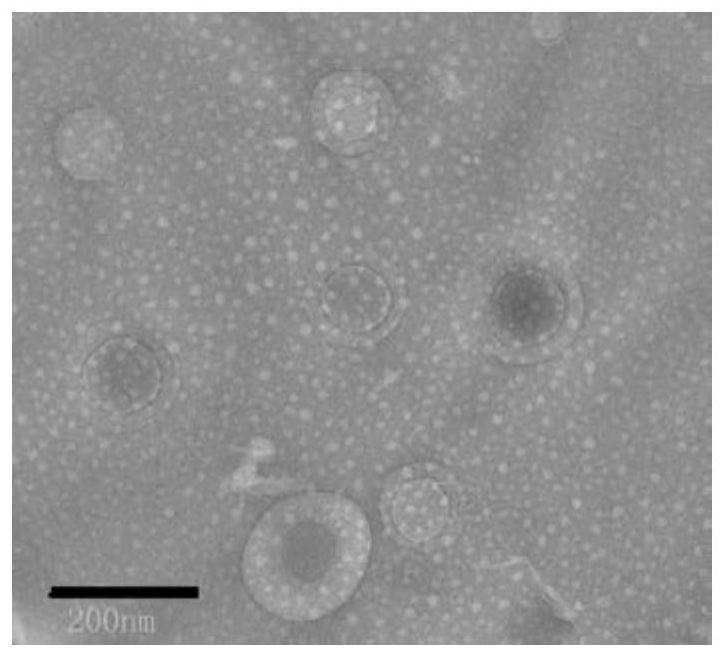 Polymer carrier and preparation method thereof, anti-tumor nanoparticles