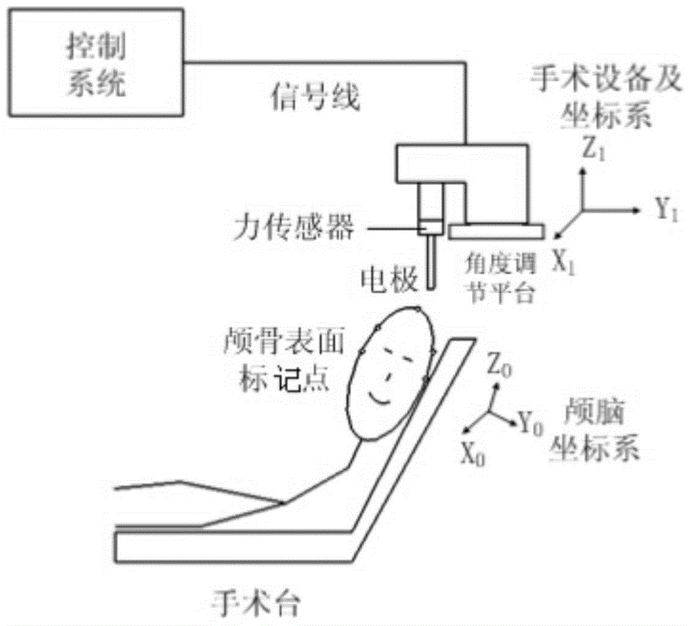 Force-sensor-based coupling method for extracranial and intracranial coordinate systems in brain stereotactic surgery of neurosurgery