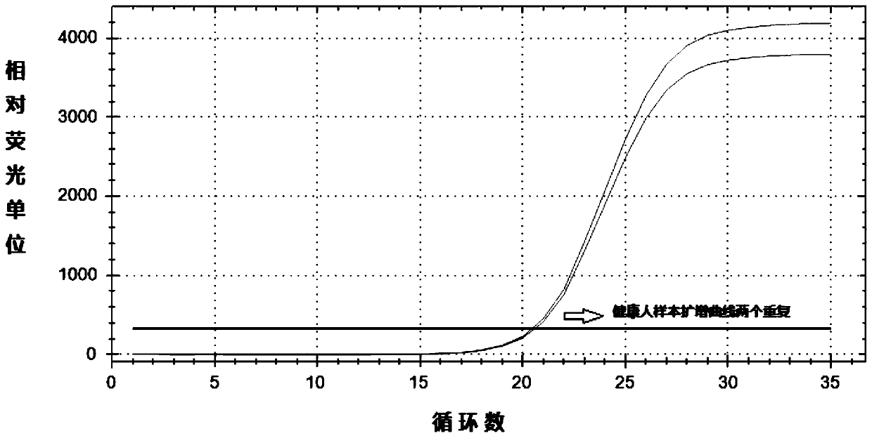 A kit and method for extracting DNA from exfoliated cells in human feces samples