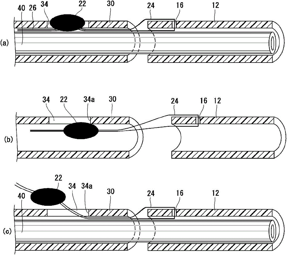 Stent delivery system