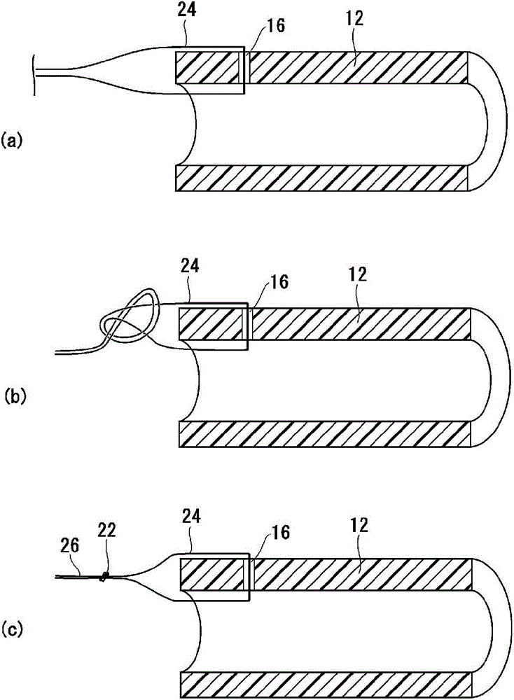 Stent delivery system