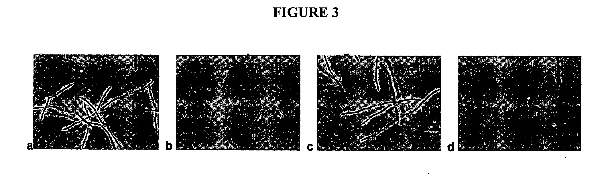 Neutralization of bacterial spores