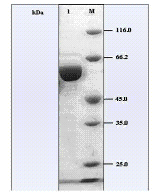 Carboxylesterase and application thereof in degradation of pesticides malathion and carbaryl