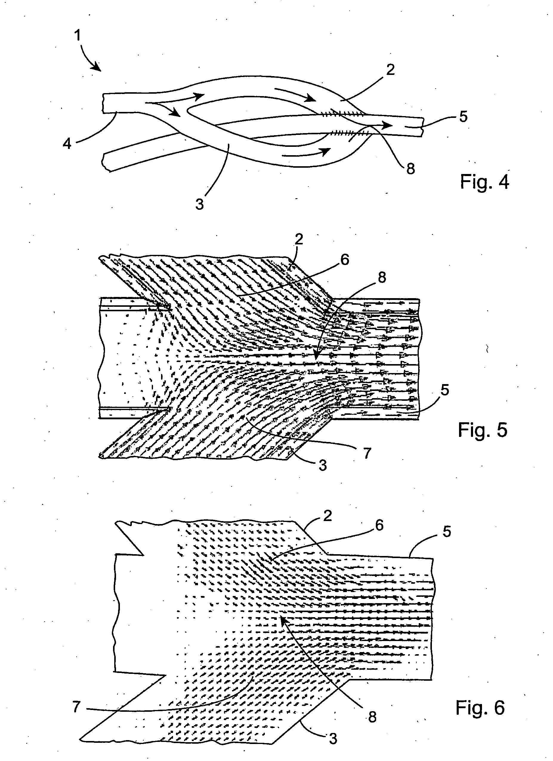 Vascular graft