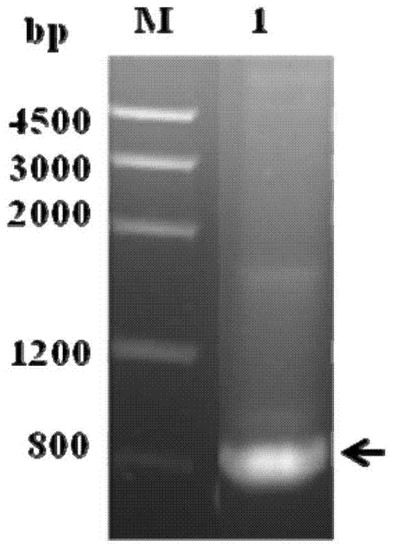 Novel hydatidosis diagnosing antigen and application thereof