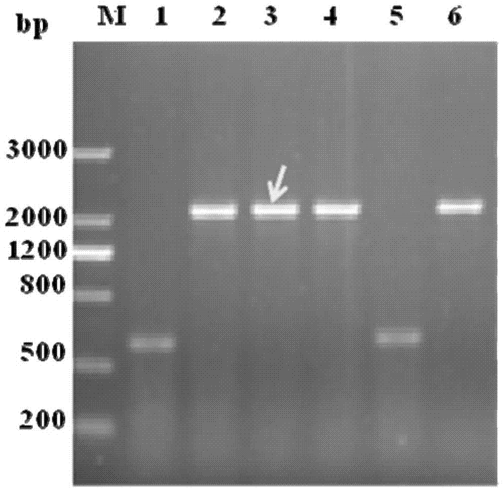 Novel hydatidosis diagnosing antigen and application thereof