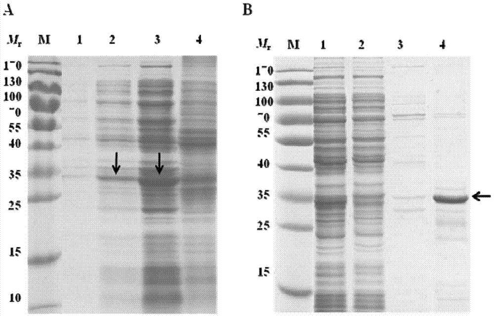 Novel hydatidosis diagnosing antigen and application thereof