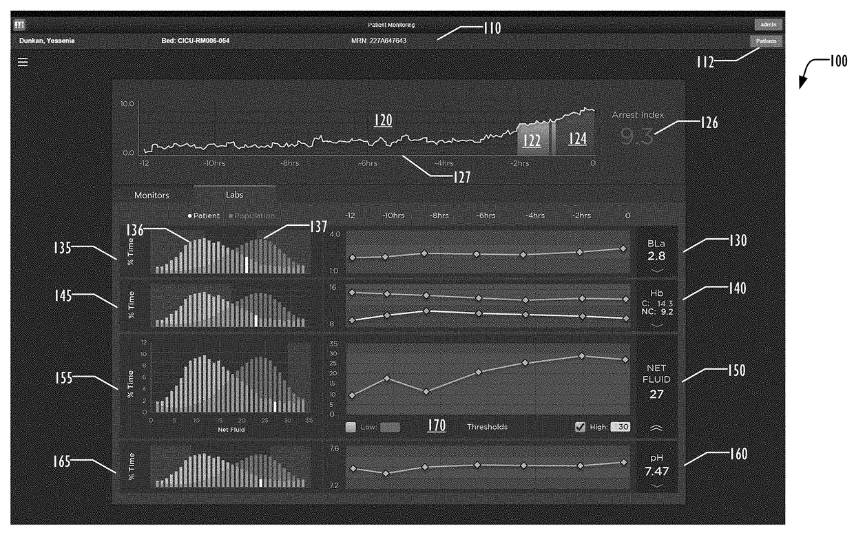 User interface for displaying predictive cardio information