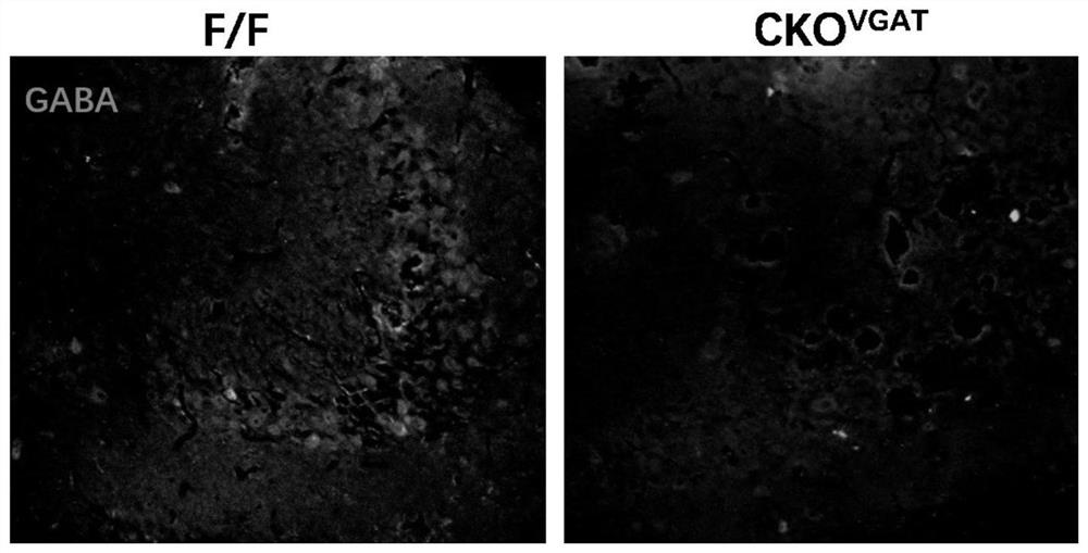 A kind of construction method of animal model of epilepsy