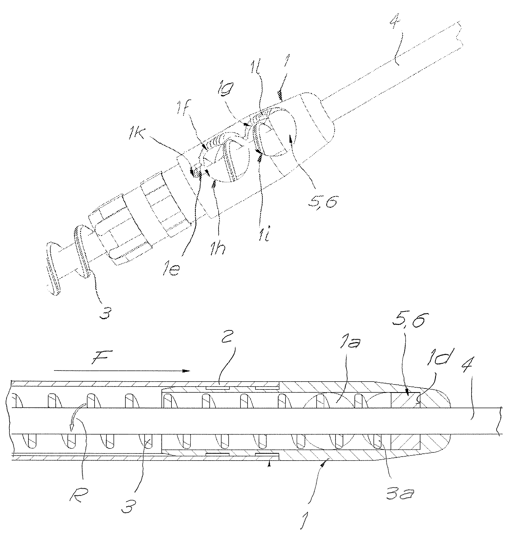 Catheter for aspirating, fragmenting and removing extractable material from blood vessels