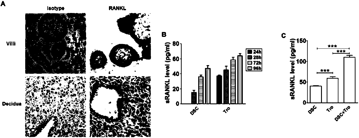 Application of RANK&lt;+&gt; macrophages in preparation of medicament for treating spontaneous abortion and preventing miscarriage