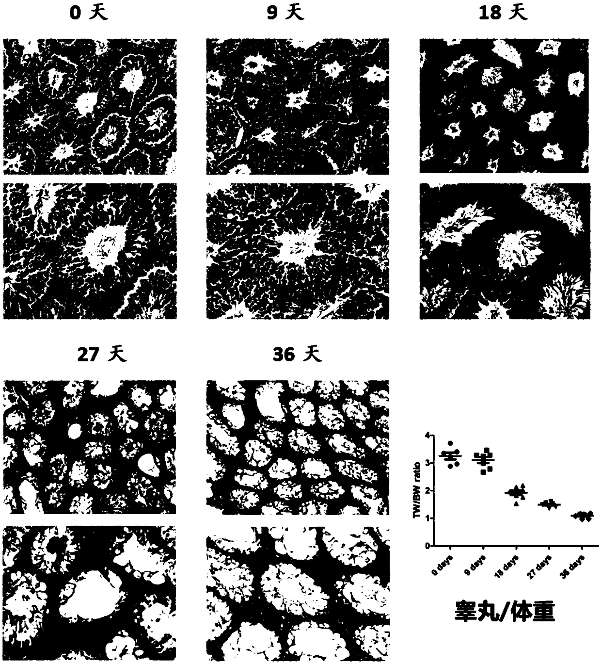 Method for constructing azoospermia mouse model