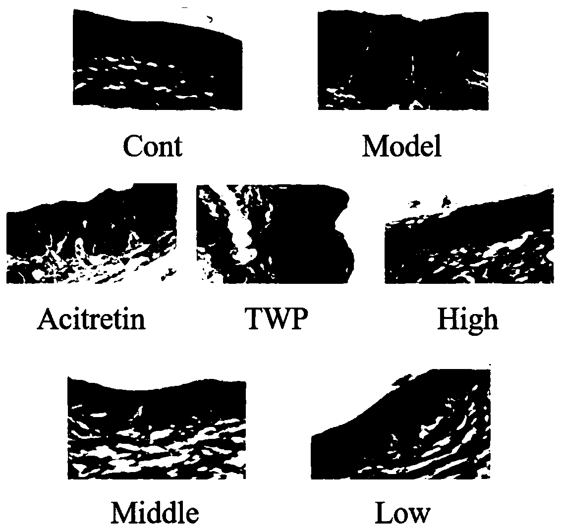 Preparation method and application of total physalin extract