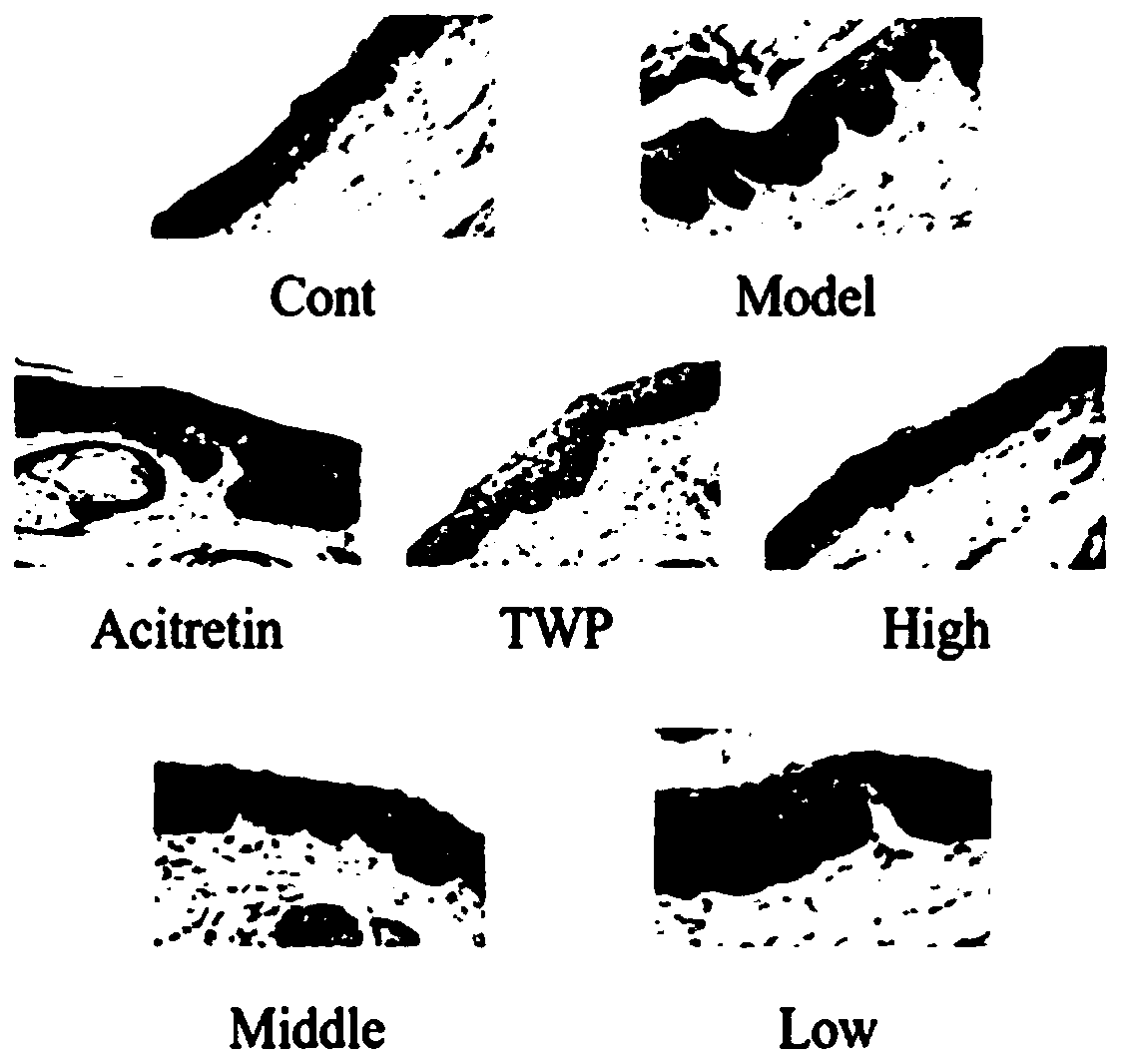 Preparation method and application of total physalin extract