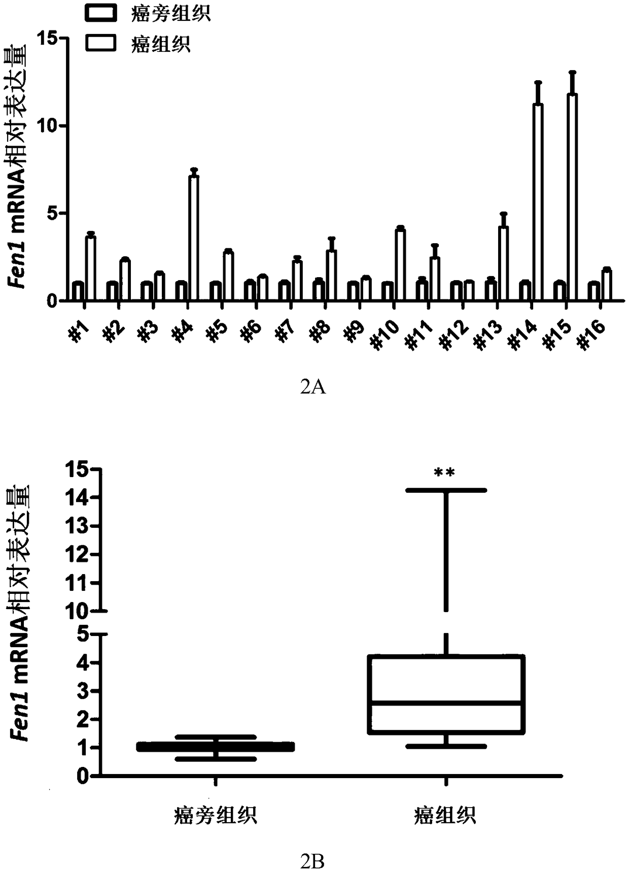 Application of reagent for detecting expression level of FEN1 gene to preparation of reagents used for diagnosing and predicting invasion and metastasis of liver cancer