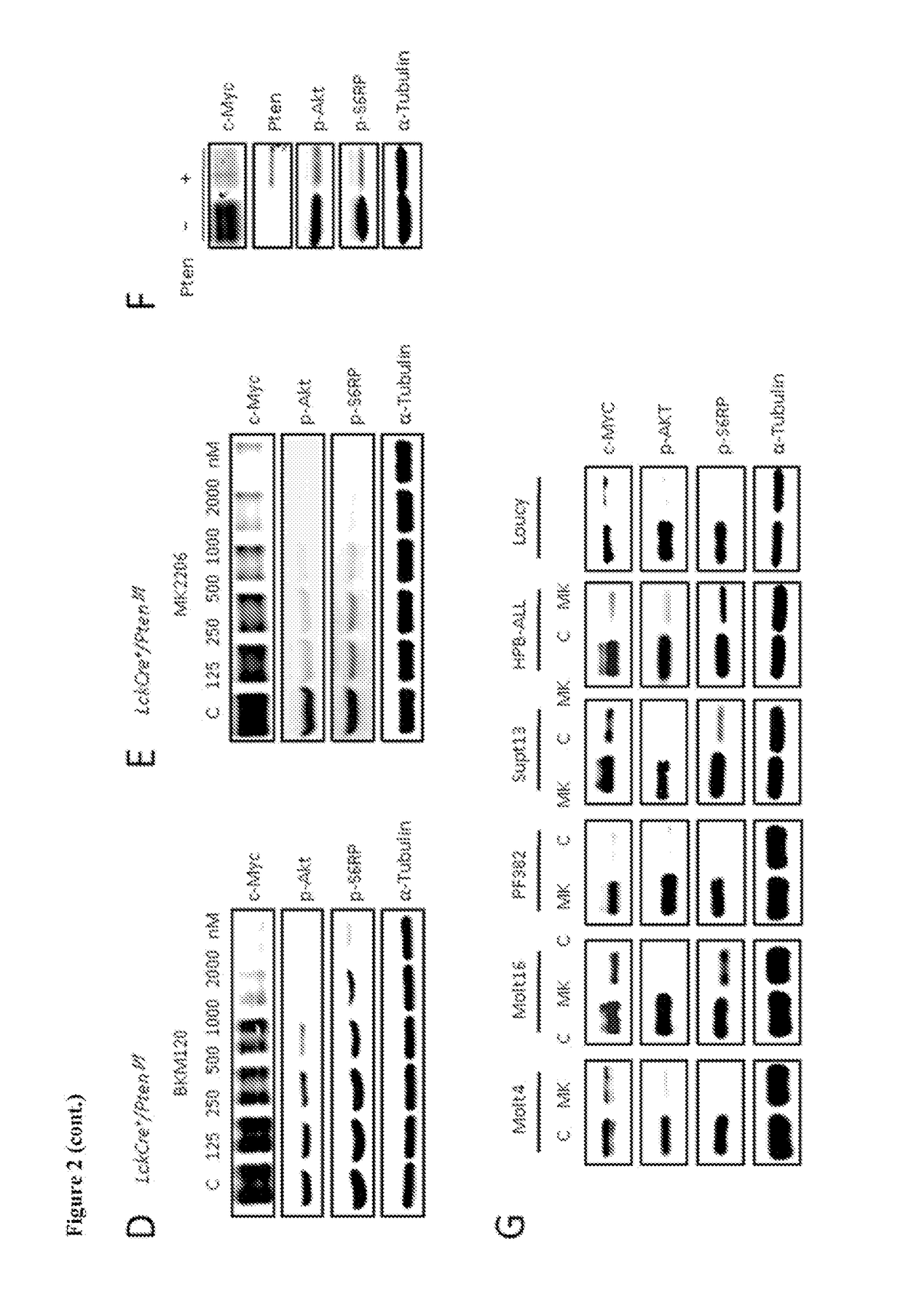 P13k-mtorc1-s6k1 signaling pathway biomarkers predictive of Anti-cancer responses