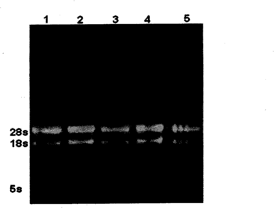 Method for detecting lily seed virus