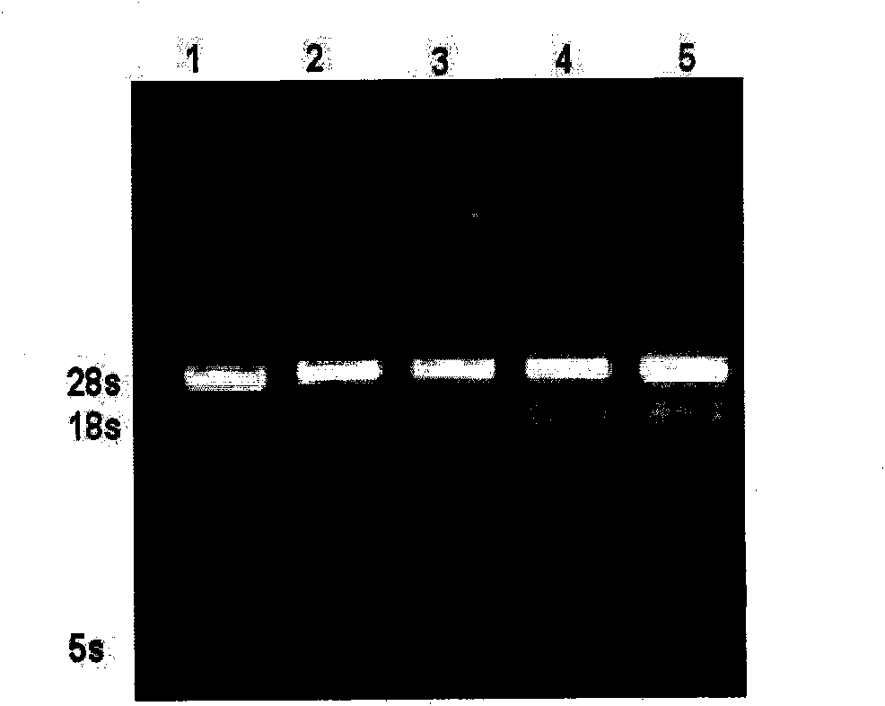 Method for detecting lily seed virus