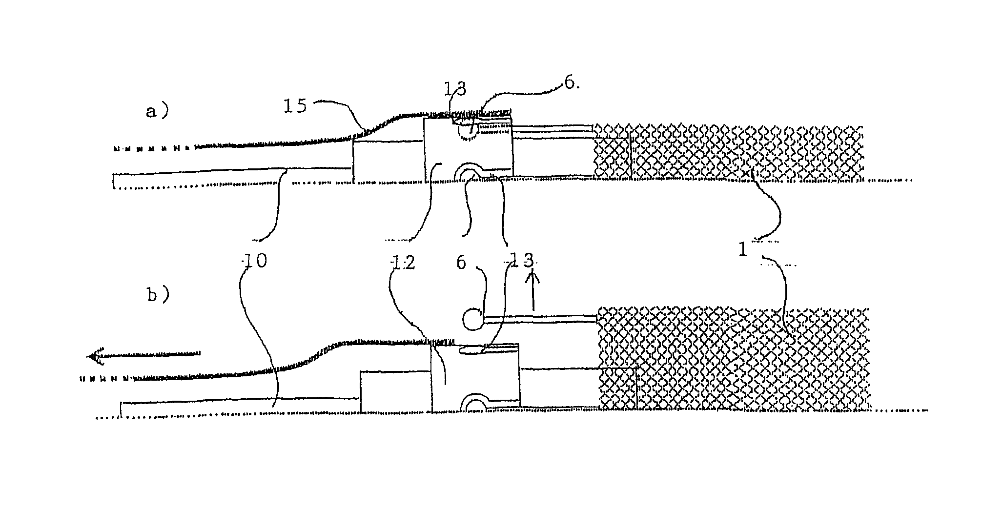 Implant for influencing blood flow