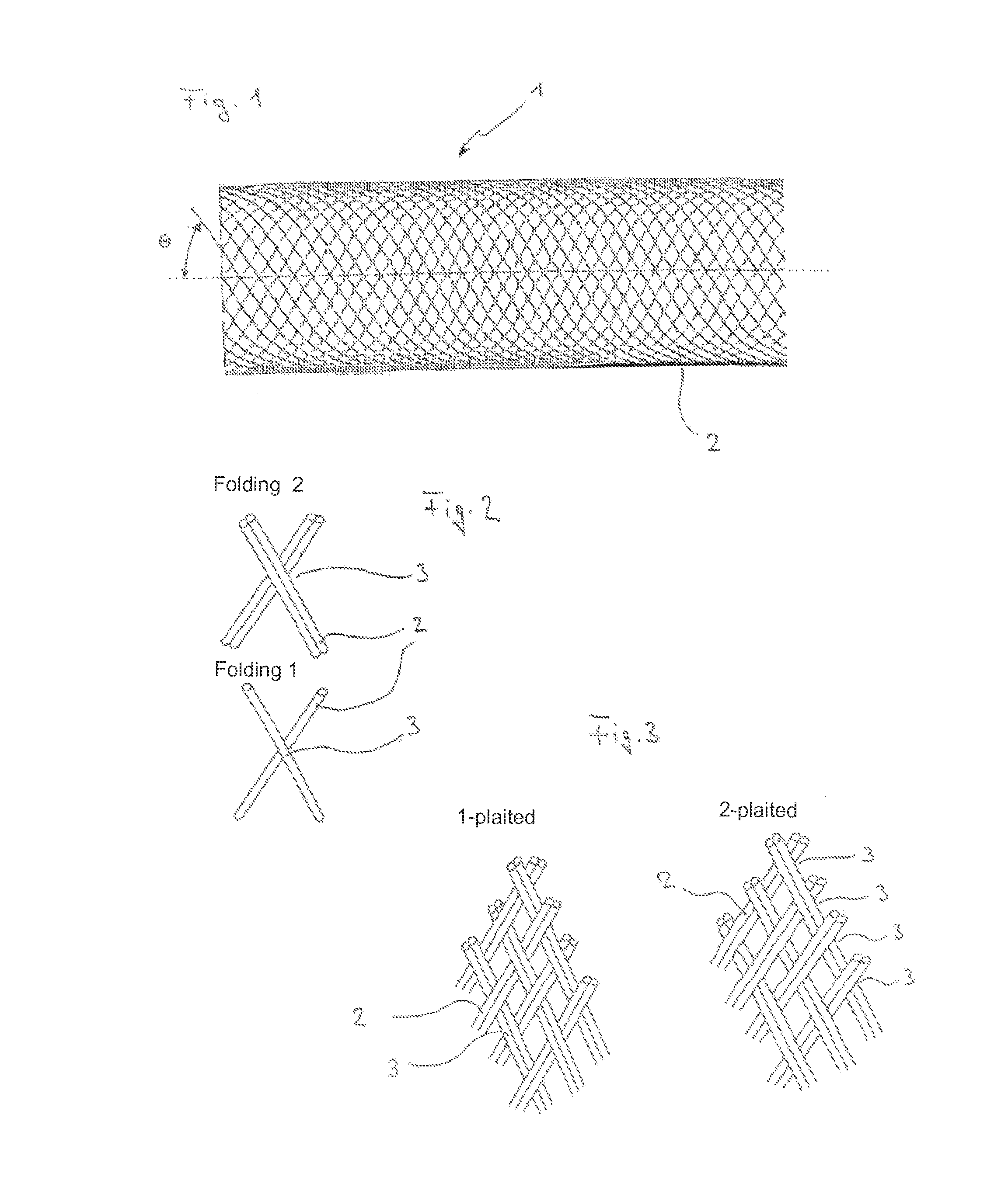 Implant for influencing blood flow