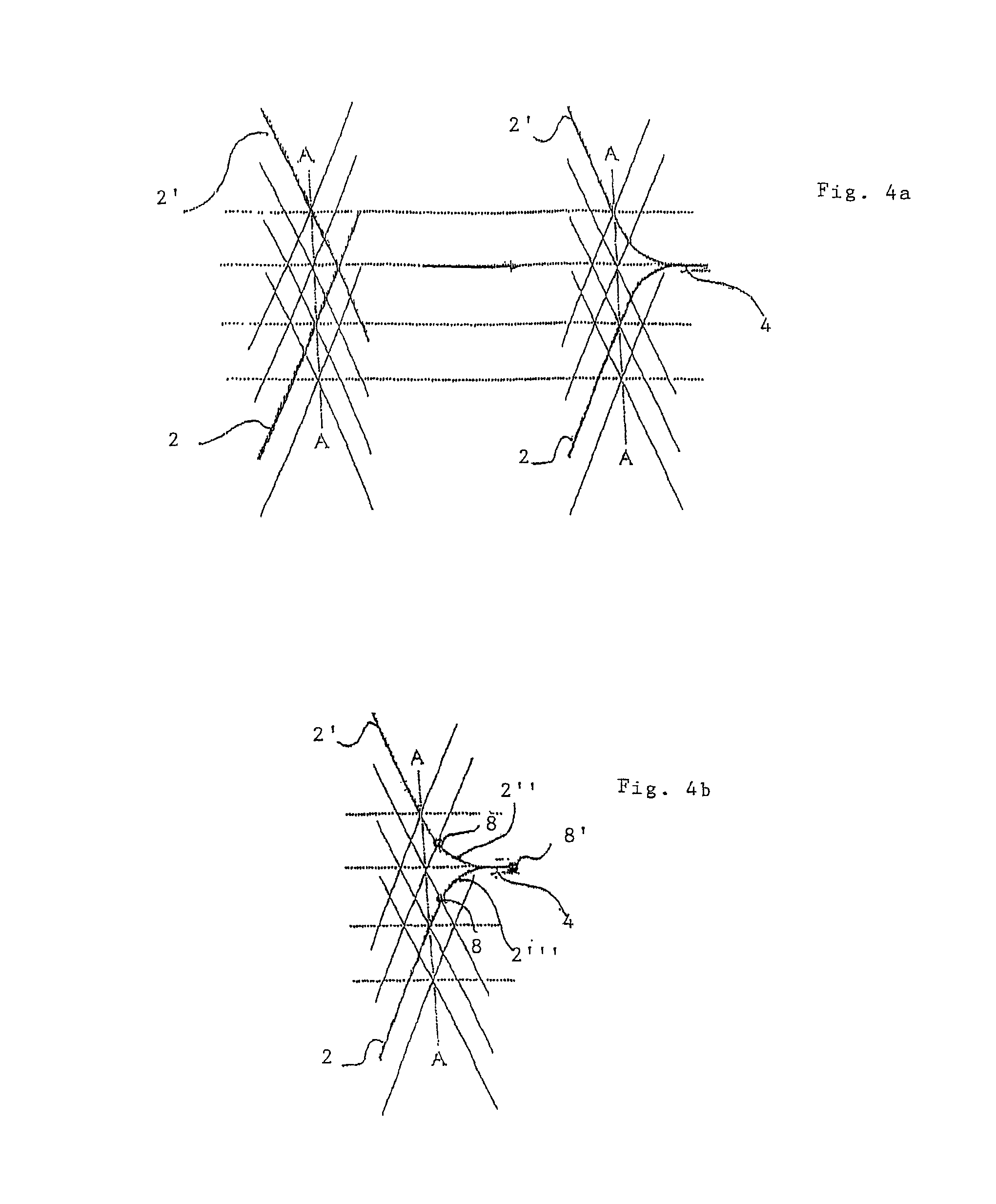 Implant for influencing blood flow