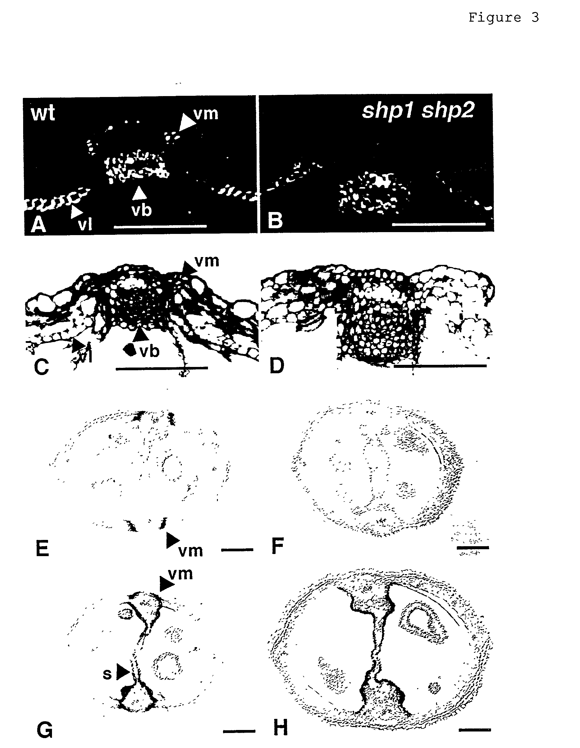 Selective control of lignin biosythesis in transgenic plants