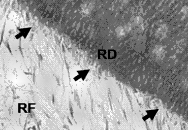 Preparation method of engineering dental pulp