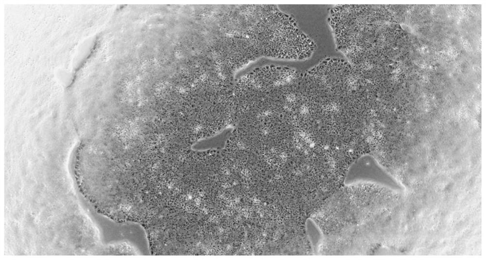 Culture medium and culture method for inducing differentiation of iPS (induced pluripotent stem) cells